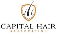 Capital Hair Restoration image 5